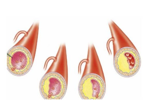 寧波供卵試管：超詳細的試管嬰兒移植全流程分享，從開始到成功只需要五步